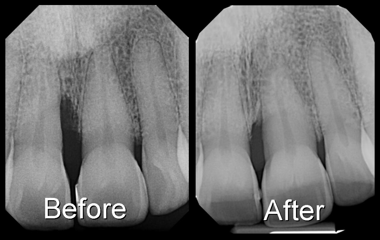 The benefits of dental perioscopy